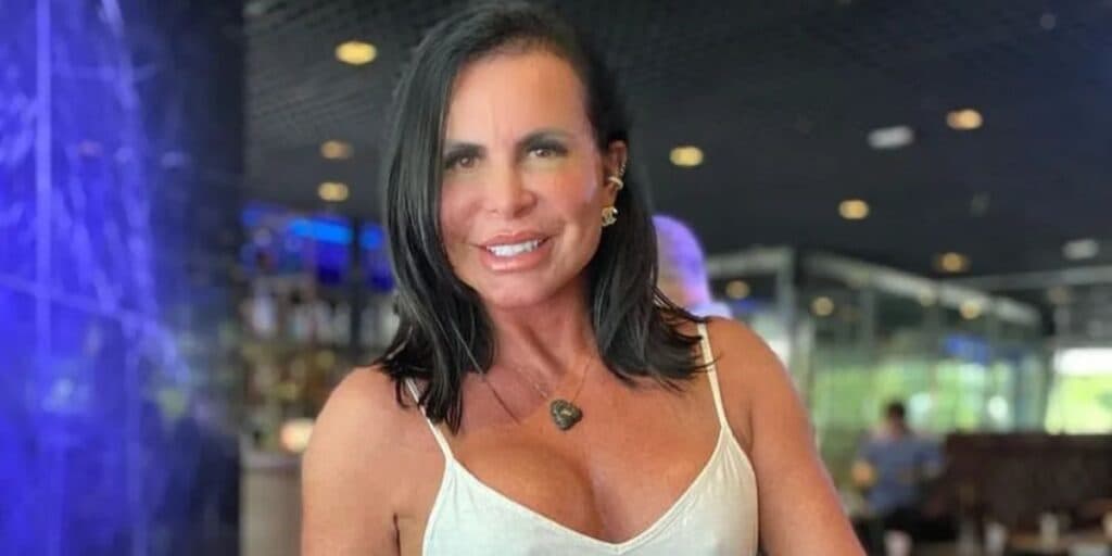 Procedimento no rosto de Gretchen aos 63 anos a faz rejuvenescer 20 e foto de antes e depois prova