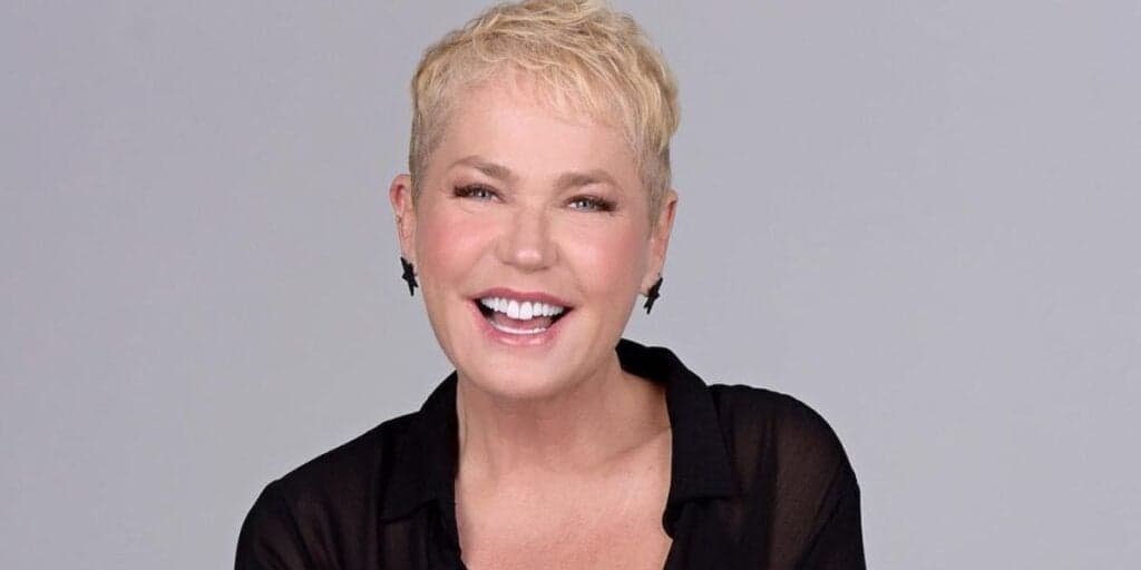 "Paralisada por seis meses": a cirurgia forçada realizada em Xuxa Meneghel com sequelas gravíssimas