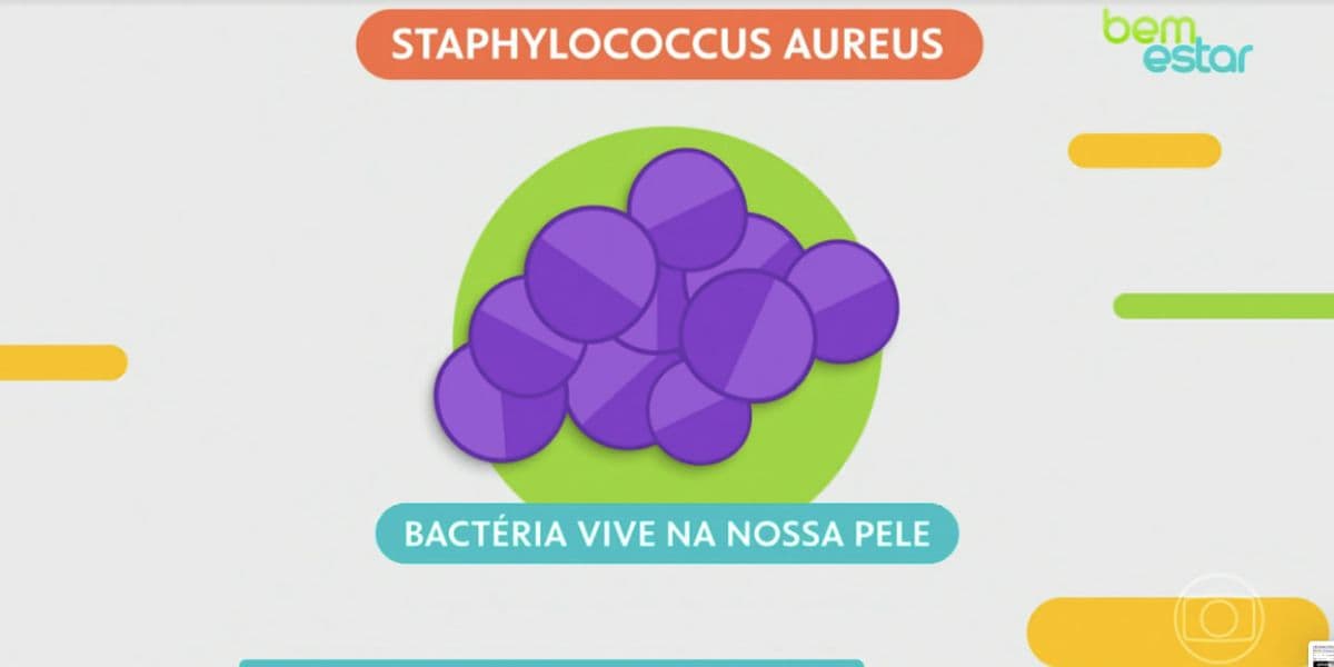 Staphylococcus aureus (Foto: Encontro da Globo) Staphylococcus aureus (Foto: Encontro da Globo)