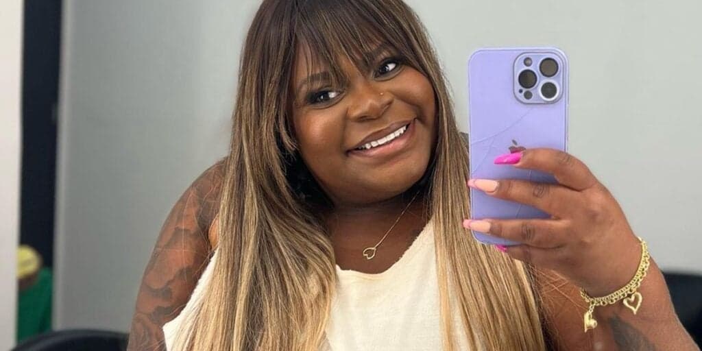 Corajosa, Jojo Todynho acaba de mostrar barriga após bariátrica e confirma nova cirurgia