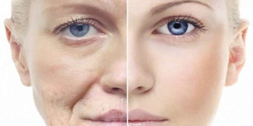 Fim do envelhecimento e adeus manchas: Receitinha caseira de colágeno NATURAL para te livrar de botox em 2024