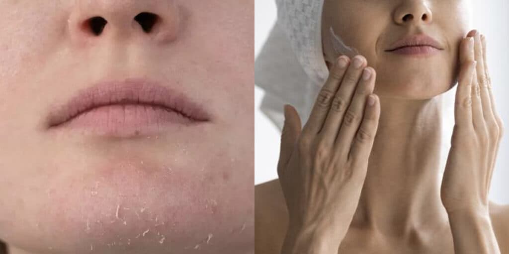Adeus pele ressecada: Misturinha caseira com café e +1 ingrediente rejuvenesce as 50+ em apenas 2 passos