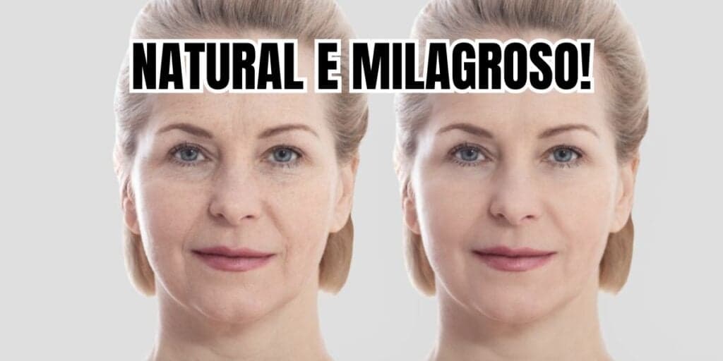 Colágeno natural deixa o botox no chinelo e acaba com as rugas (Reprodução/Montagem TV Foco) Colágeno natural deixa o botox no chinelo e acaba com as rugas (Reprodução/Montagem TV Foco)