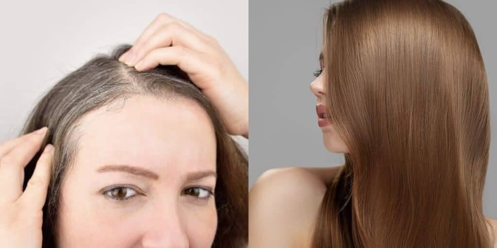 Adeus imediato ao cabelo branco: 3 óleos naturais garantem fim do grisalho e rejuvenescem mais que plástica