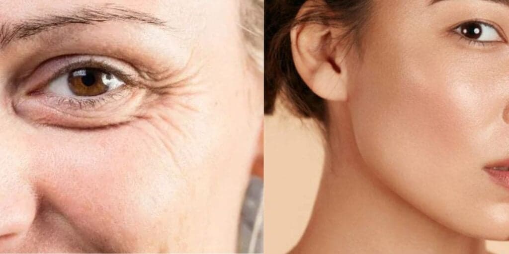 Fim IMEDIATO das rugas: Receitinha milagrosa com mel e +2 ingredientes caseiros rejuvenesce senhoras de 60+