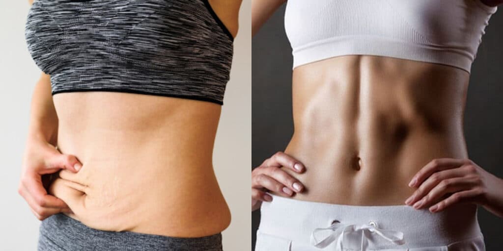 Fim da flacidez na barriga: Receita milagrosa com 4 ingredientes rejuvenesce sua pele em poucos dias