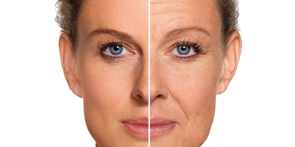 Mais potente que o botox: Mistura com 5 ingredientes elimina as rugas naturalmente e traz pele de porcelana