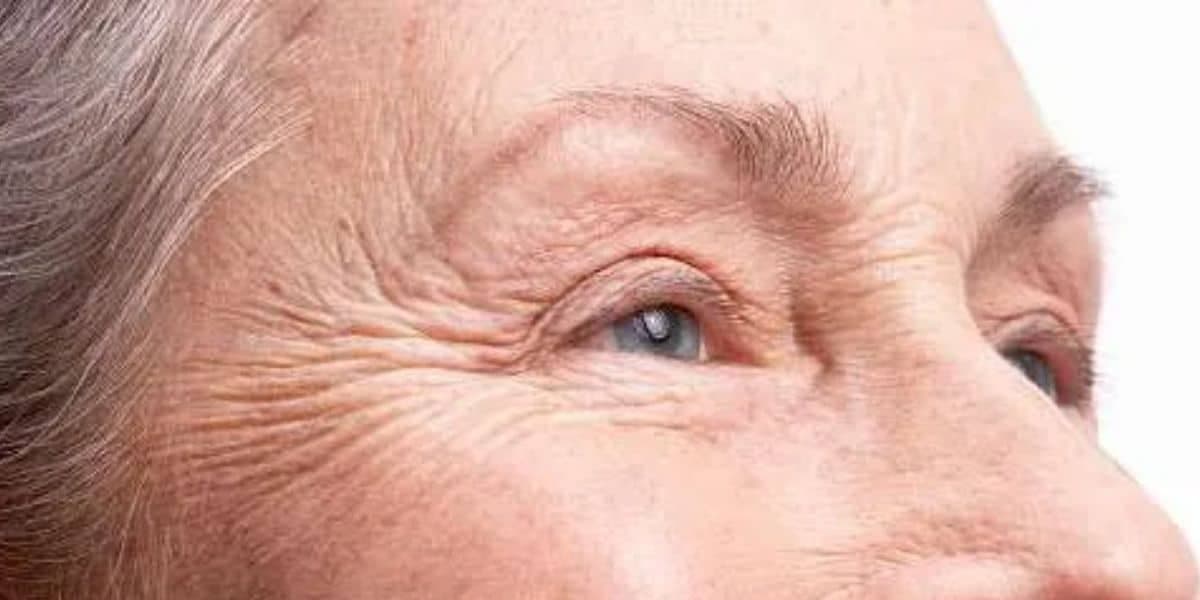 As rugas vão diminuir com a utilização desses produtos naturais (Reprodução: Internet) As rugas vão diminuir com a utilização desses produtos naturais (Reprodução: Internet)