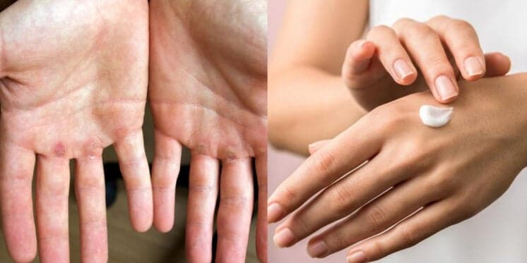 Mãos macias e sem calos: Misturinha caseira com apenas 4 ingredientes hidrata a pele em 5 minutinhos