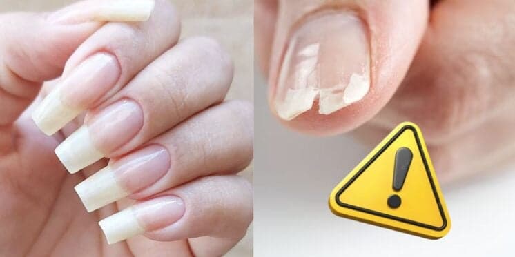 Unhas grandes e quebradas (Fotos: Reproduções / Internet / Freepik) 