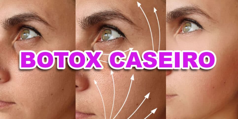 Fonte da juventude: Botox caseiro com 3 ingredientes dá fim as rugas e devolve 30 anos durante a noite