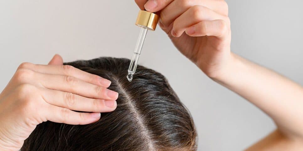 Minoxidil sendo aplicado no cabelo (Reprodução: Internet) Minoxidil sendo aplicado no cabelo (Reprodução: Internet)