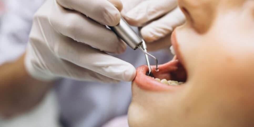 Vá de maneira constante, ao menos a cada 6 meses, para fazer a limpeza (Reprodução: Internet) Vá de maneira constante, ao menos a cada 6 meses, para fazer a limpeza (Reprodução: Internet)