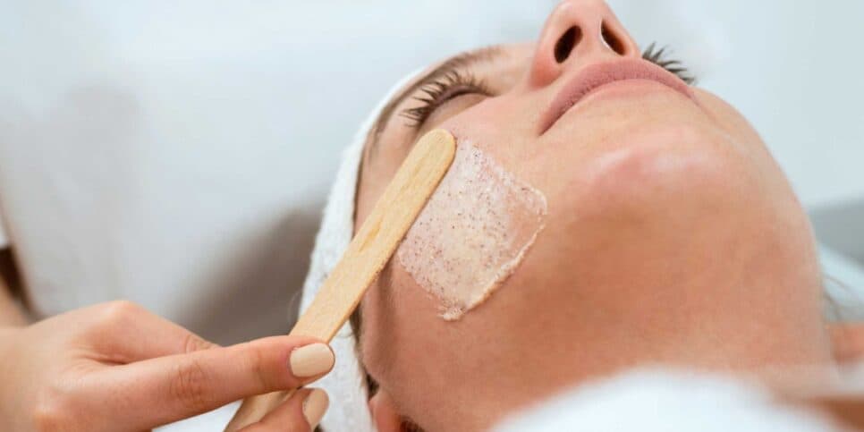 Peeling de fenol - Foto: Internet Peeling de fenol - Foto: Internet