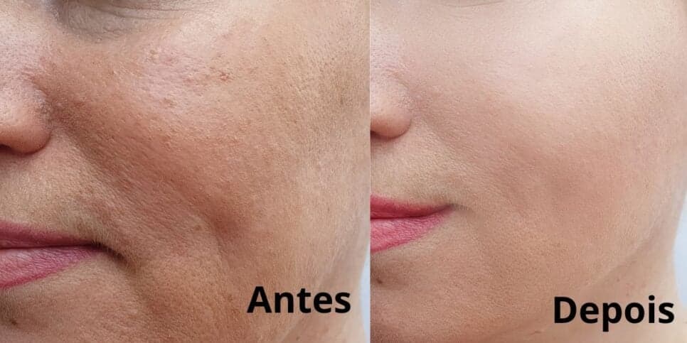 Harmonização caseira sem gastar 1 real: 3 ingredientes para rejuvenescer enquanto dorme