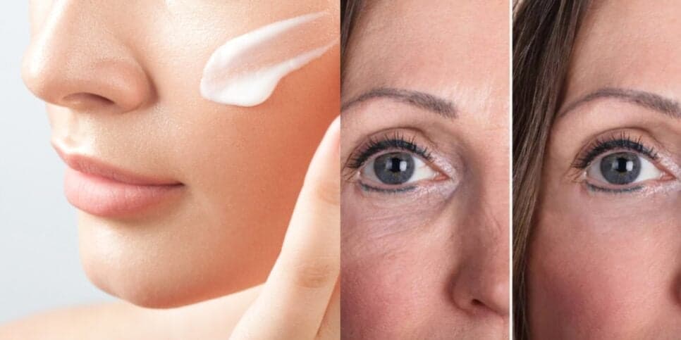 Nem Avon e Natura fazem isso: Creme natural tem o melhor colágeno do mundo e tira rugas com só 1 ingrediente