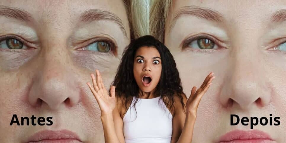 Adeus às rugas em 15 minutos: Harmonização facial caseira, com 2 ingredientes, te deixa com carinha de 20