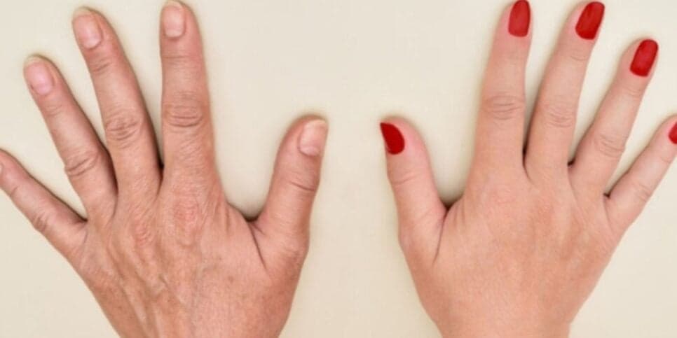Mãos 30 anos mais jovem: Misturinha com 3 ingredientes dá adeus ao ressecamento e aos calos em apenas 5 minutos