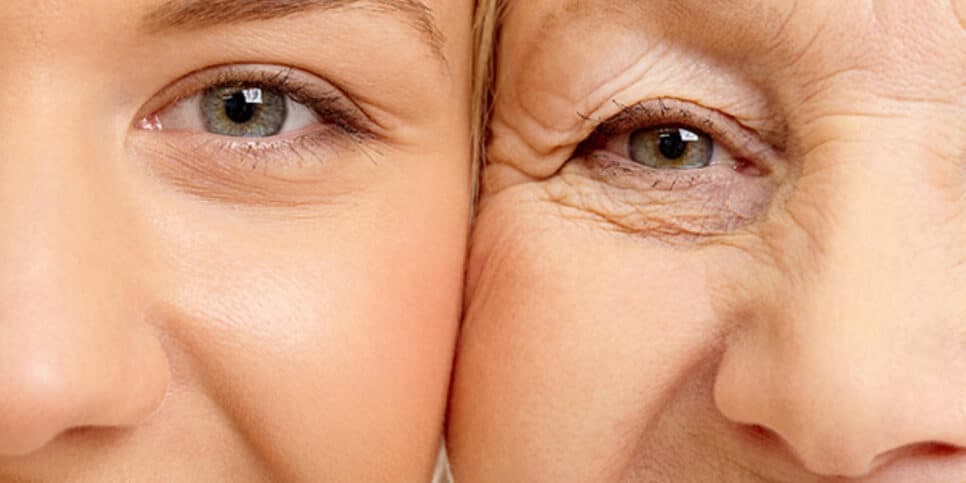 Tchau, botox: Mistura com 2 ingredientes dá fim as rugas e flacidez de idosas 60+