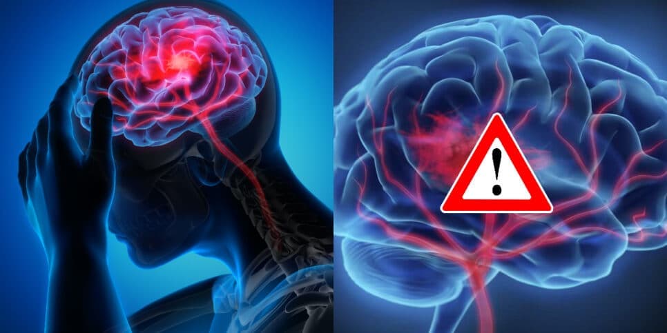 De enjoo a braço dormente: Revelados os sinais comuns que você ignora e indicam um AVC muito EM BREVE