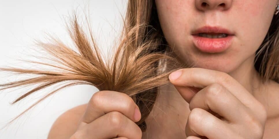 Cabelo Oleoso Cabelo Oleoso