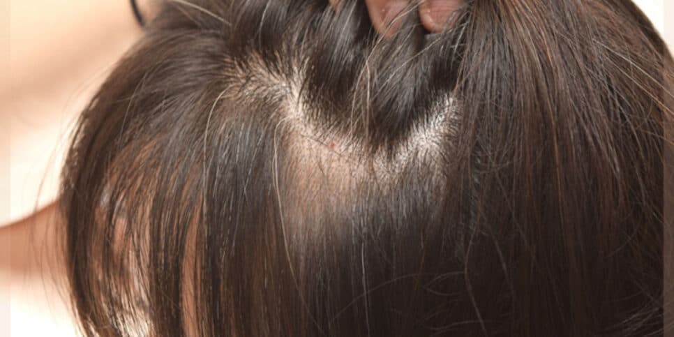 Adeus cabelo branco com essa receita natural (Foto: Montagem) Adeus cabelo branco com essa receita natural (Foto: Montagem)