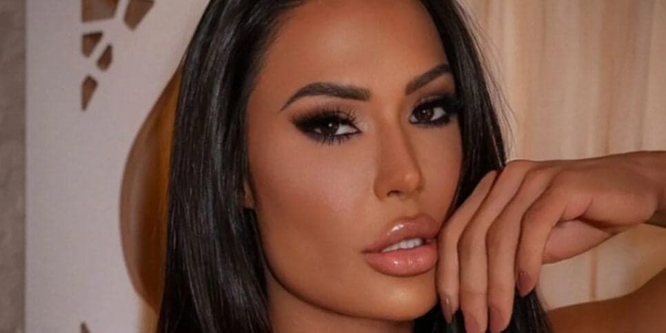Gracyanne Barbosa remove plásticas e harmonização do rosto e está irreconhecível - Foto: Internet Gracyanne Barbosa remove plásticas e harmonização do rosto e está irreconhecível - Foto: Internet
