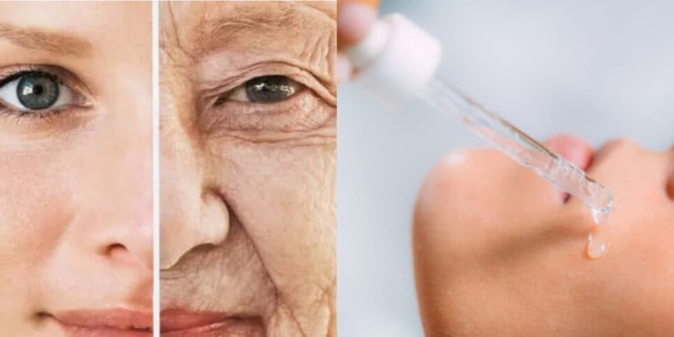 Falência das clínicas de estética: Ácido hialurônico caseiro com 5 ingredientes suga rugas das 60+