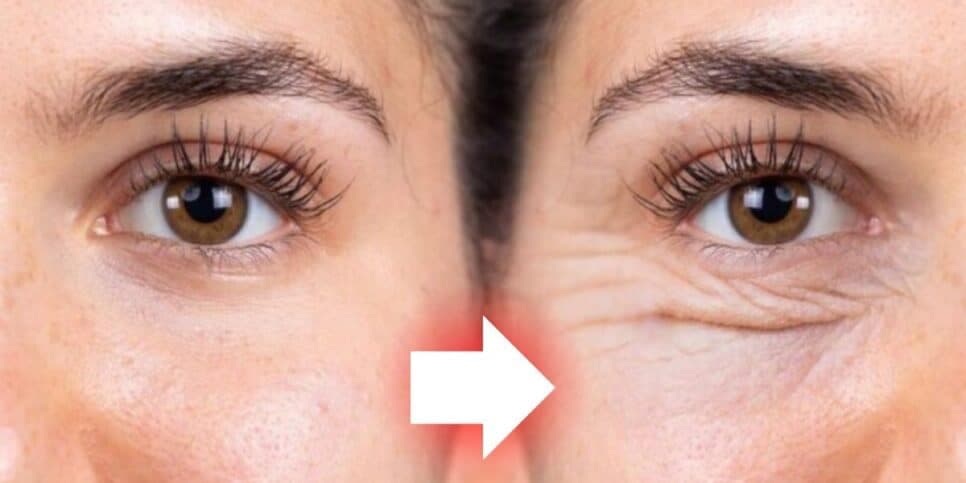 Mulheres de 30 com cara de 60+: Único ingrediente destrói colágeno e faz rugas germinarem
