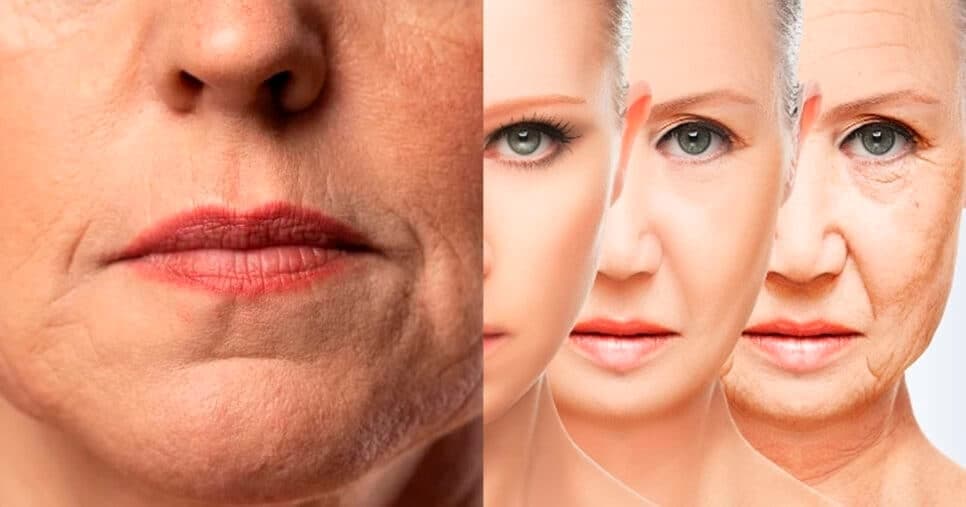 Fim do bigode chinês e estrias: 1 ingrediente reduz rugas, elimina marcas e rejuvenesce senhoras