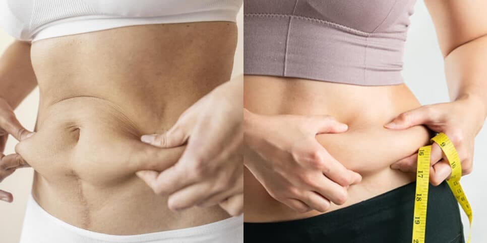 Adeus gordura abdominal: Único ingrediente infalível da sua geladeira te emagrece para o verão