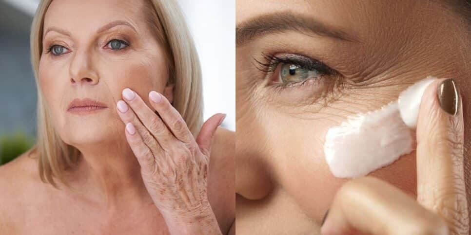 Tchau, rugas: Receitinha com 5 ingredientes caseiros rejuvenesce até 20 anos em apenas 15 minutos