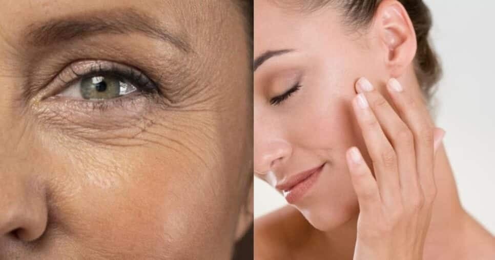 Adeus rugas e manchas na pele: Receita de botox caseiro rejuvenesce às 50+ e traz pele de porcelana
