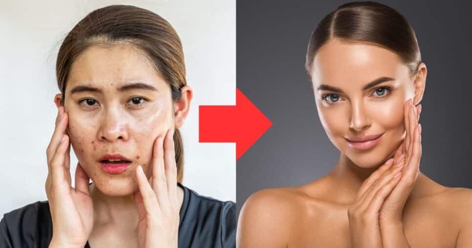 Adeus cravos e pele oleosa: 6 passos infalíveis remove todas as impurezas do rosto em menos de 15 minutos