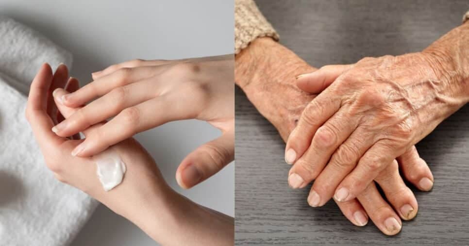 Adeus rugas e manchas na pele em 15 minutos: Misturinha caseira com 3 ingredientes rejuvenesce as mãos