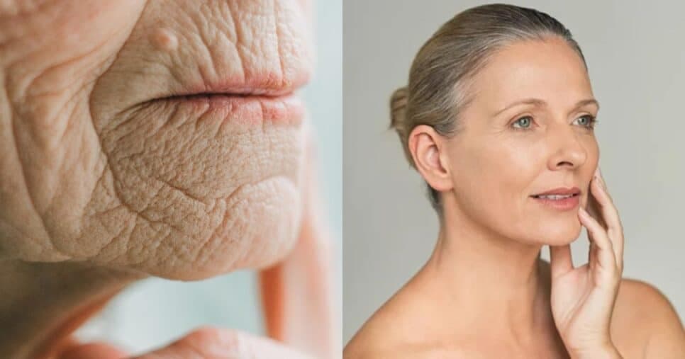Botox natural: Máscara de pepino +1 ingrediente paralisa o envelhecimento e extermina rugas
