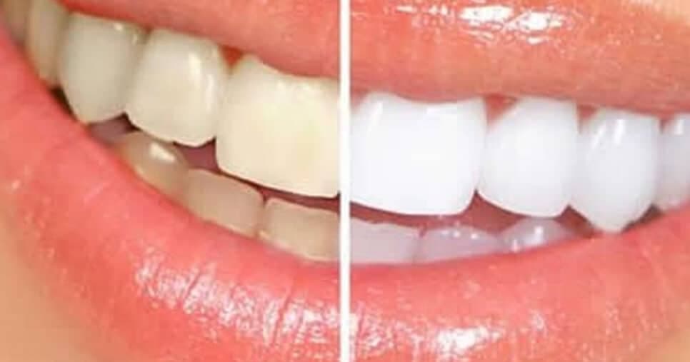 Bomba de colágeno e clareia até os dentes: 5 alimentos populares ideais para rejuvenescer todo o rosto