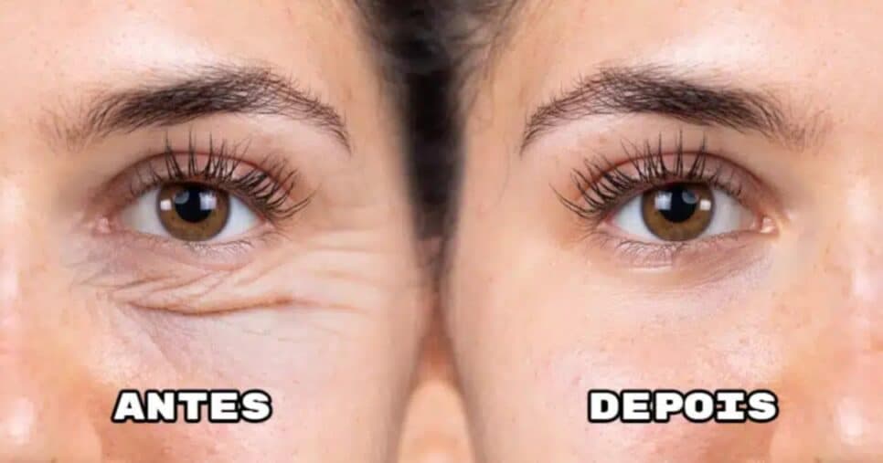 Imagem do post Imagem do post