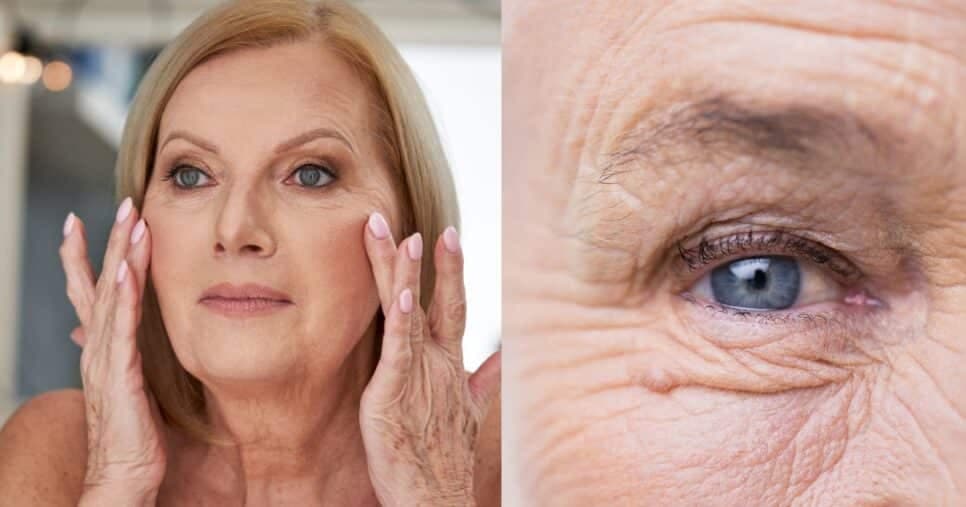 Rostinho de 25 eterno: Harmonização facial caseira com 2 ingredientes tira rugas e linhas de expressão