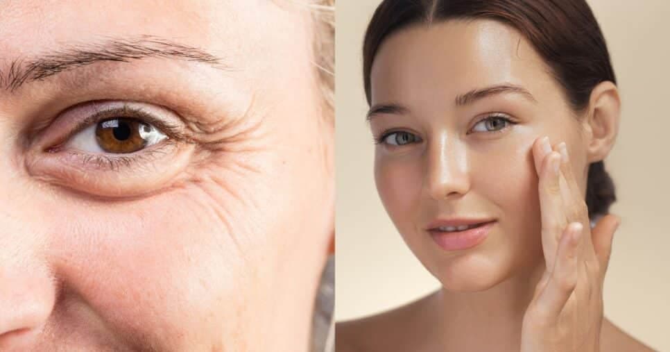 Efeito harmonização facial: Máscara caseira só com 2 ingredientes suga rugas das 55+ e hidrata a pele