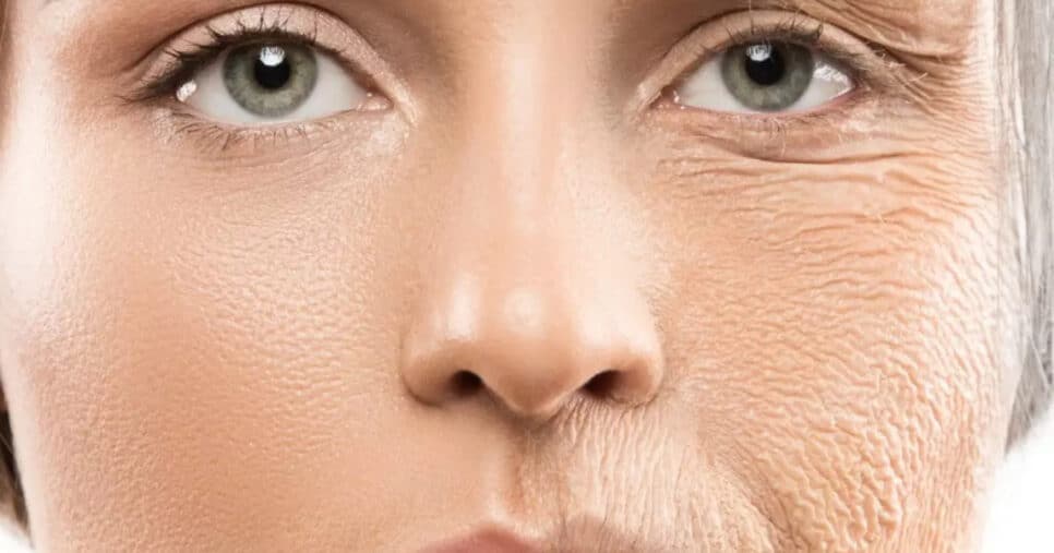 Máscara caseira com apenas 4 ingredientes aniquilam as rugas e rejuvenescem 30 anos às 60+