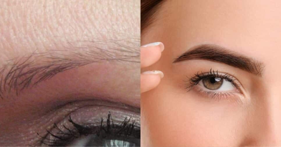 Adeus salões e dor com agulhas: Micropigmentação facial caseira traz sobrancelha impecável em 5 minutos