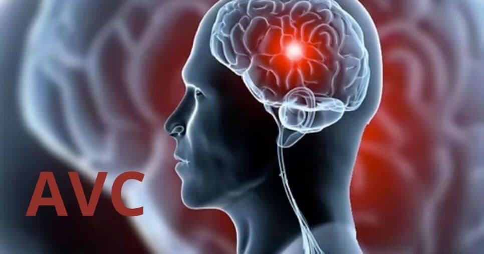 Acidente Vascular Cerebral (AVC) - Foto: Internet Acidente Vascular Cerebral (AVC) - Foto: Internet