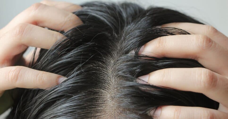 Cabelo oleoso (Foto: Canva) Cabelo oleoso (Foto: Canva)