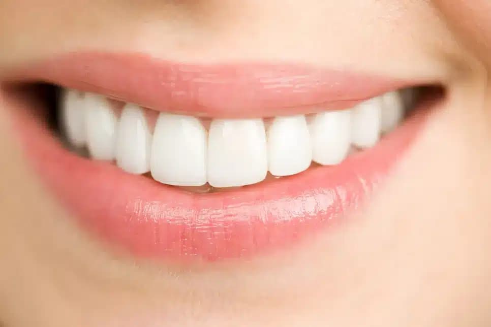 Dentes perfeitamente alinhados (Foto: Reprodução/ Internet)
