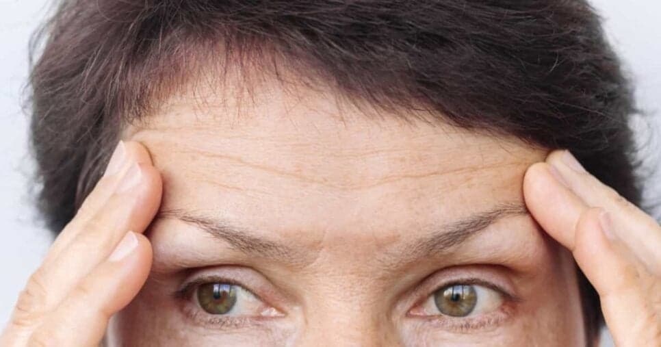 Misturinha de botox caseiro com apenas 2 ingredientes traz fim das rugas nas mulheres