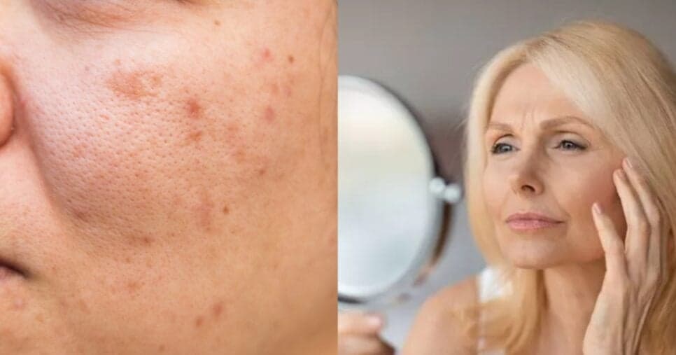 Pele renovada com óleo natural que clareia manchas, suaviza rugas e traz efeito calmante e anti-inflamatório
