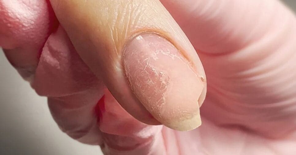 Dica das manicures: 4 passos para recuperar e salvar suas unhas quabradas