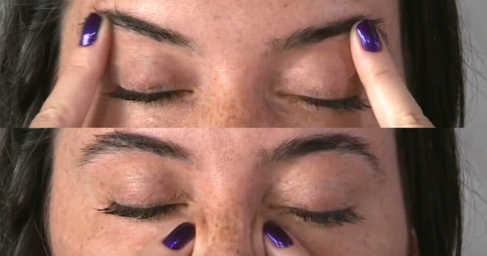 Círculos ao redor dos olhos- Foto: YouTube