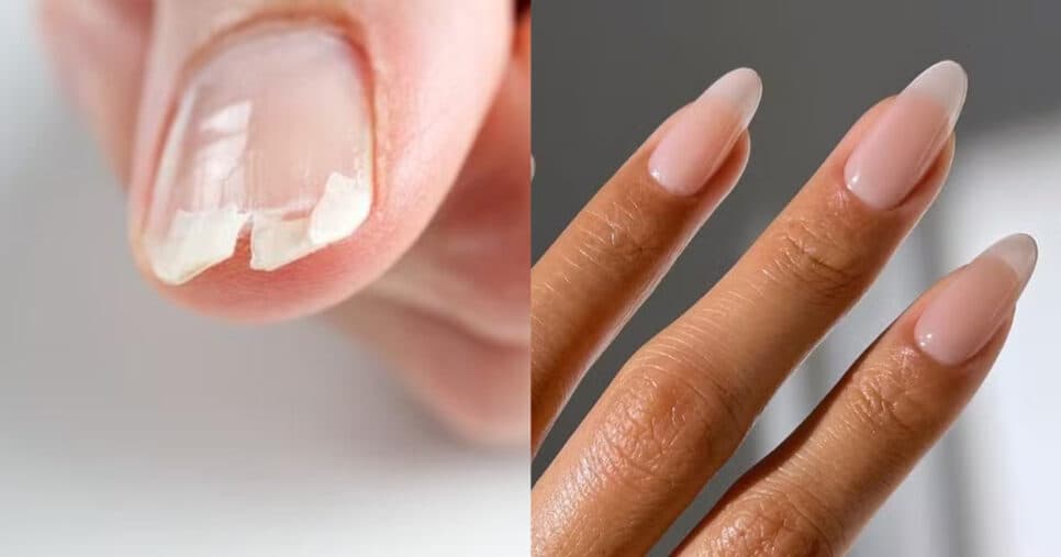 Nem a manicure te conta: Solução caseira com cravo alonga e fortalece a unhas de maneira instantânea